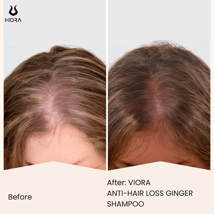 Anti-Hair Loss Ginger Shampoo